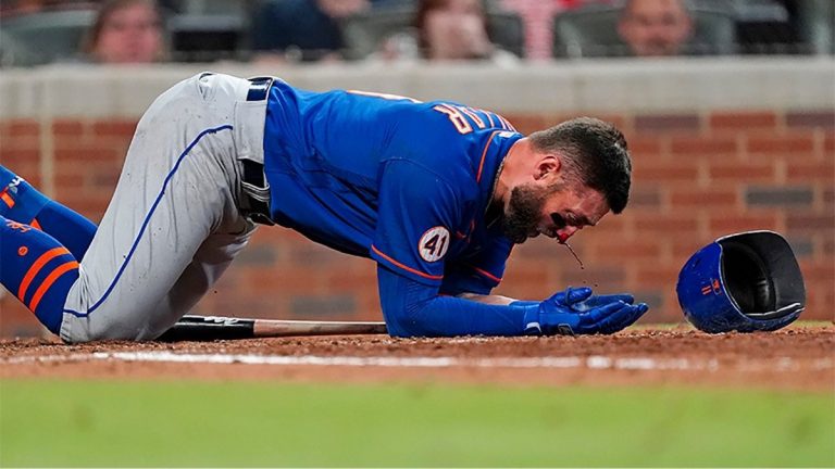 Beisbolista de los New York Mets recibe brutal pelotazo en el rostro