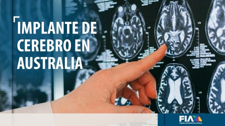 Le implantan dispositivo en el cerebro para que pensamientos controlen computadora