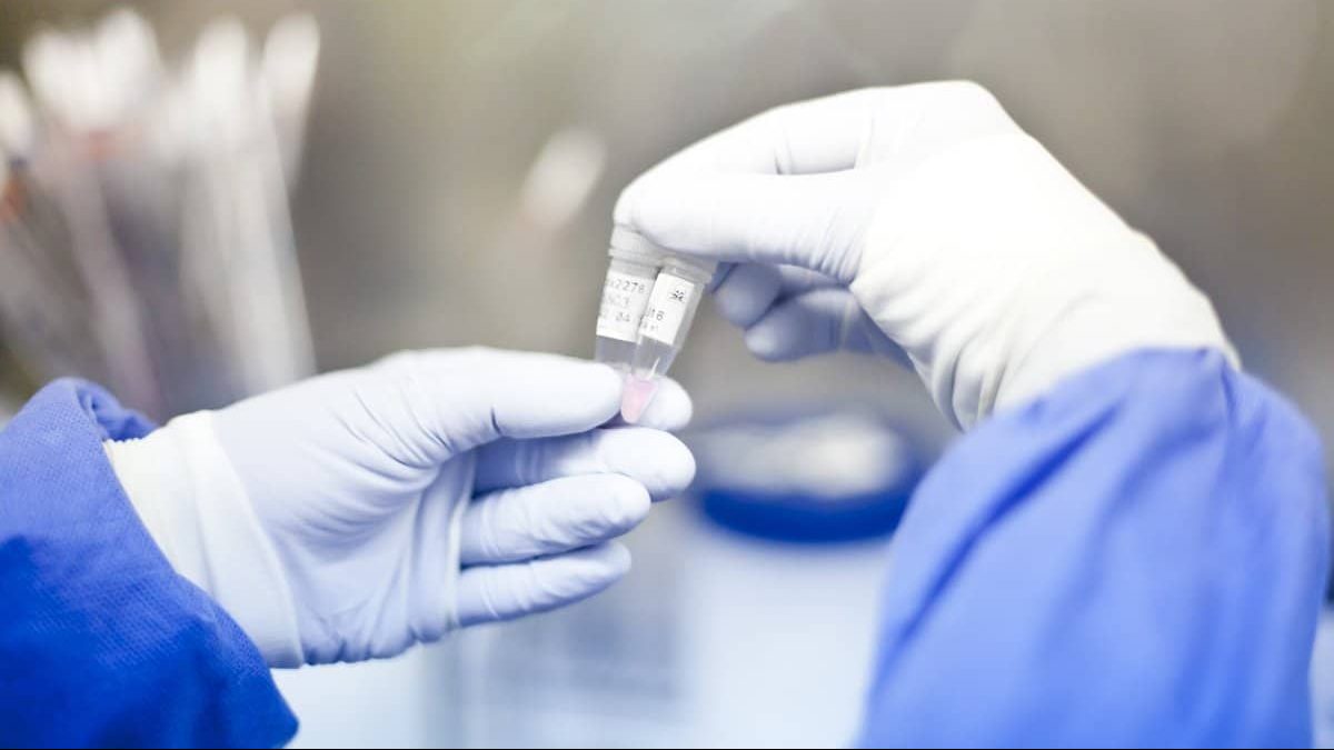 Paciente en Alemania se cura del VIH tras un trasplante de células madre